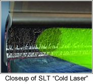 SLT Cold Laser