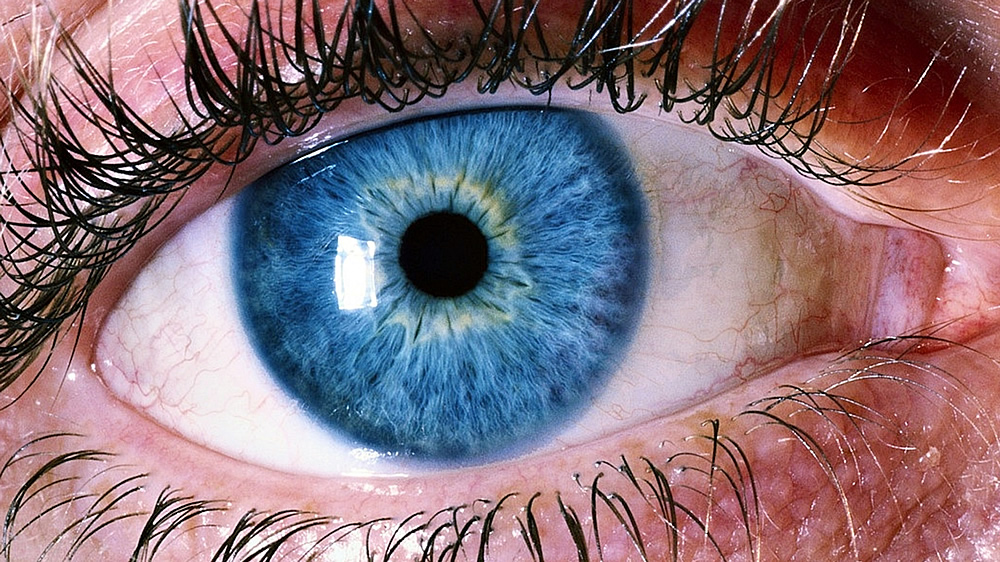 Cataract Awaress Month