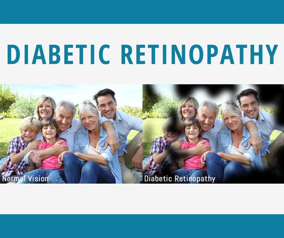 Diabetic Retinopathy?