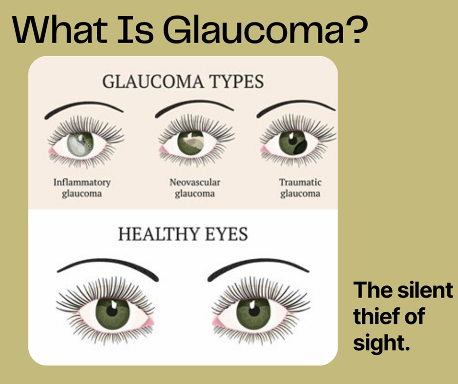 What Is Glaucoma?