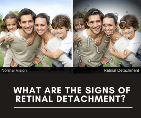 What are the Signs of Retinal Detachment