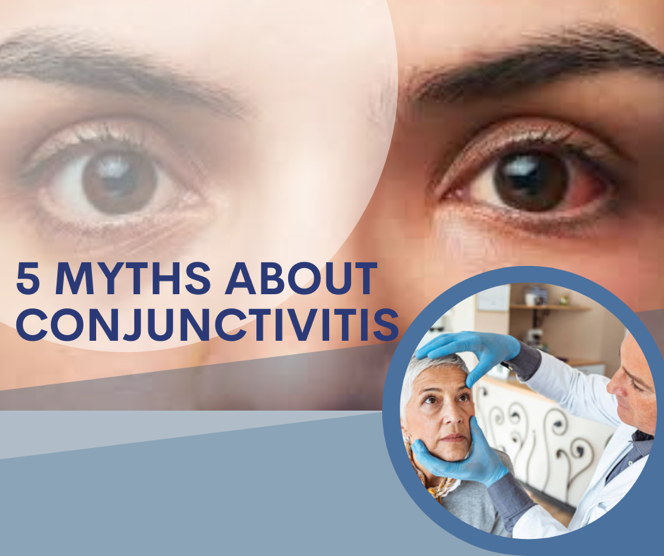 5 Myths About Conjunctivitis