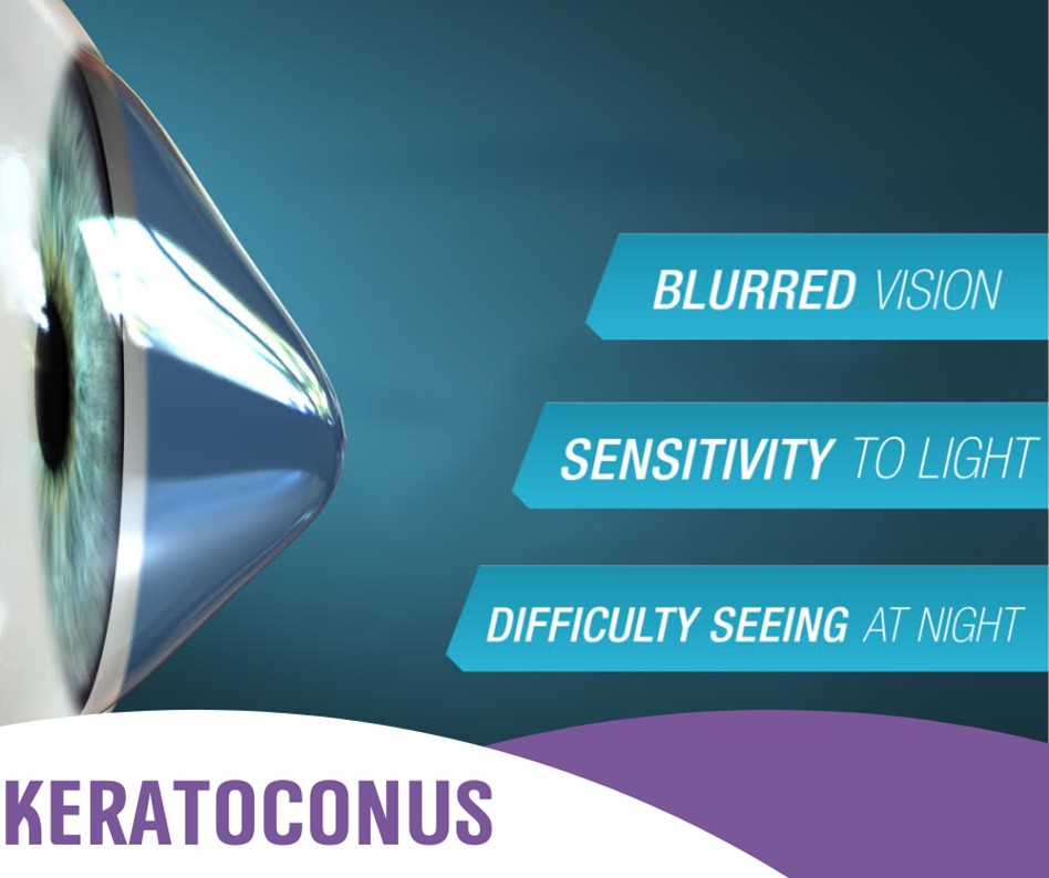 Normal vs. Keratoconus